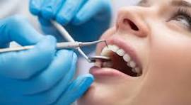 Smile Designing